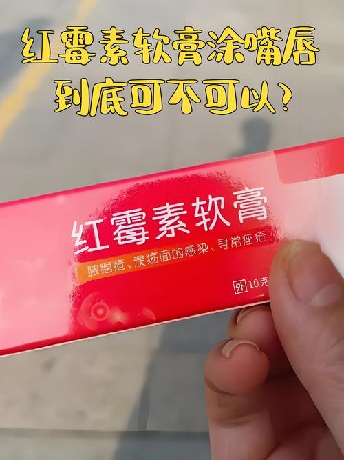 星火牛 红霉素软膏究竟该怎么用？